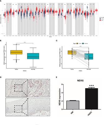 Predictive Role of NEK6 in Prognosis and Immune Infiltration in Head and Neck Squamous Cell Carcinoma